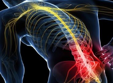 sciatica-lower-back-pain