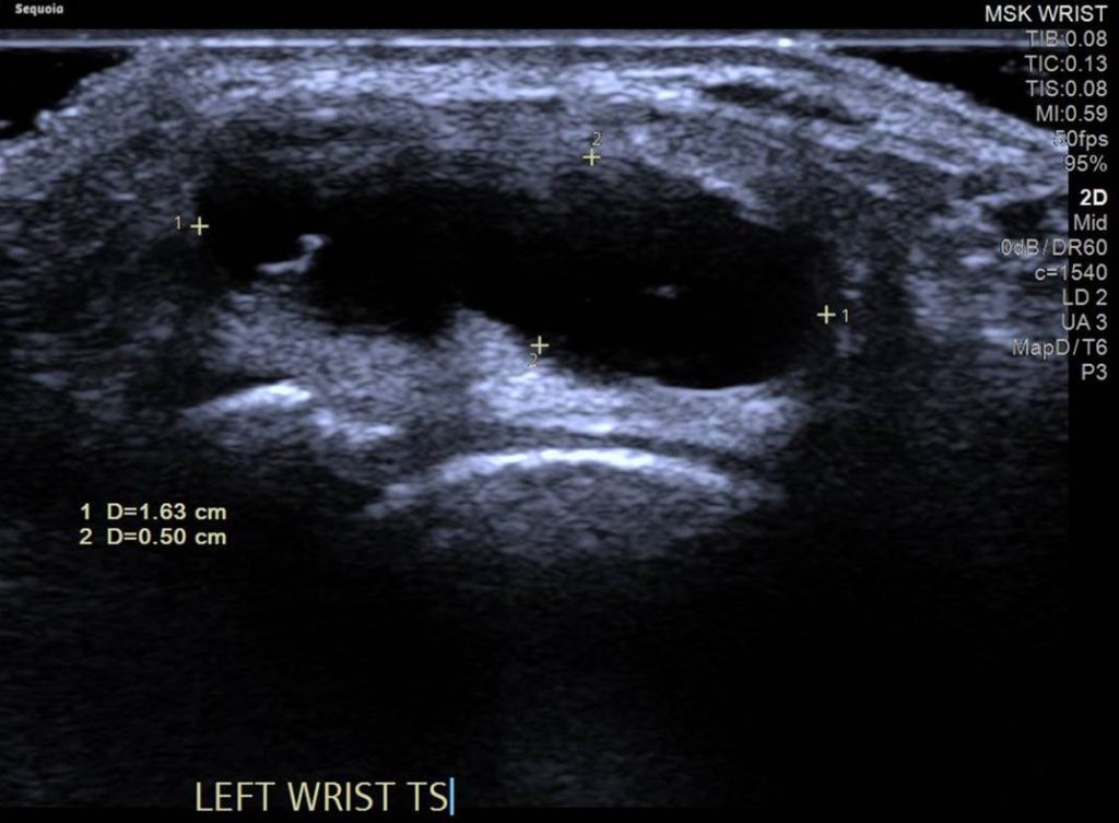 Ultrasound scans