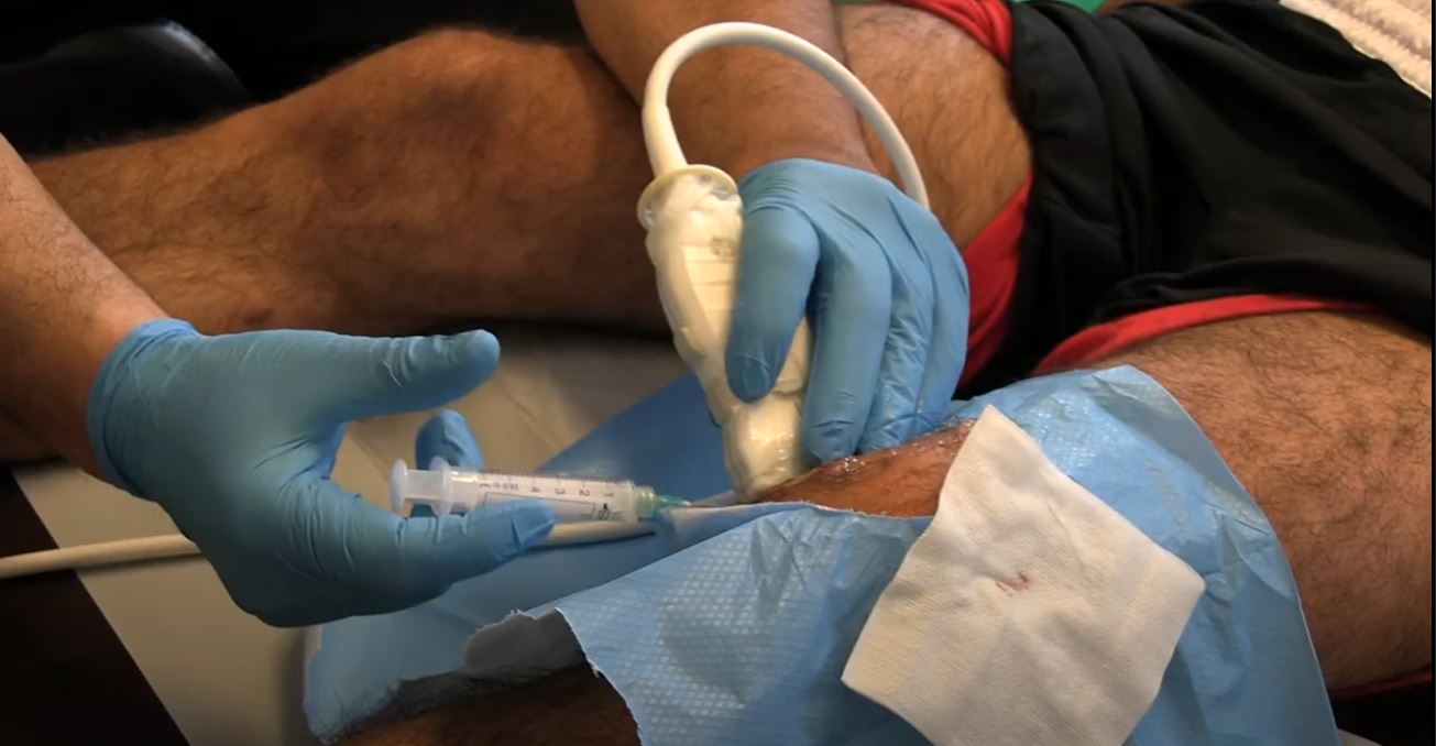 Sports Medicine Treatments