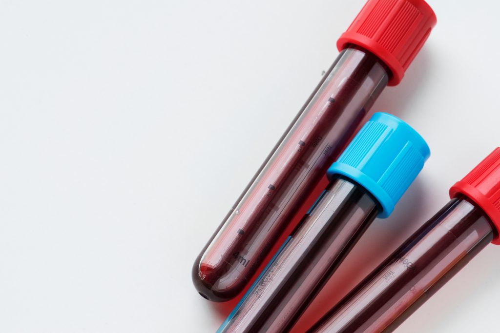 Blood Testing Services in the UK 1