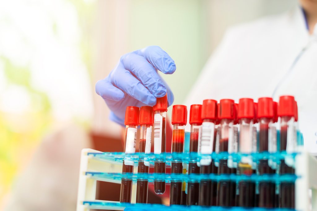 Blood Testing Services in the UK 1